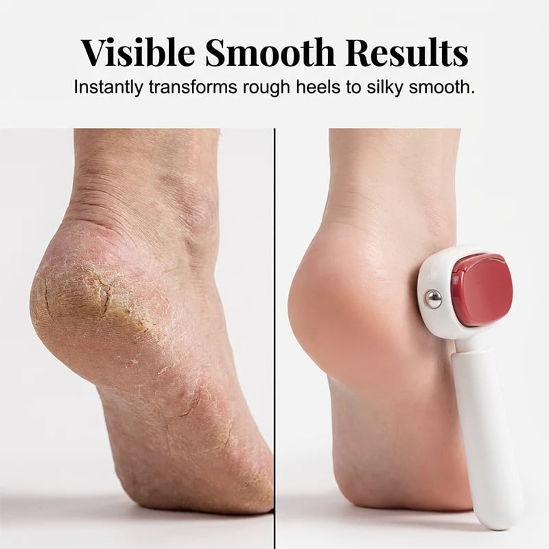 Foot file before and after result