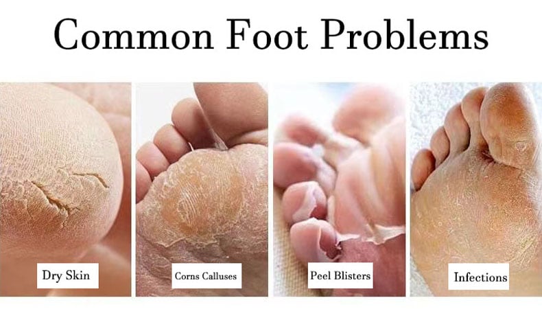 Clean Sole Foot Scrubber