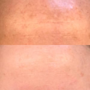 Vitamin C Freckle Dark Spot Removal Cream