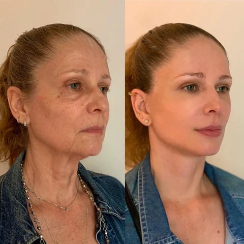 Alicia Michaels - Antes e depois