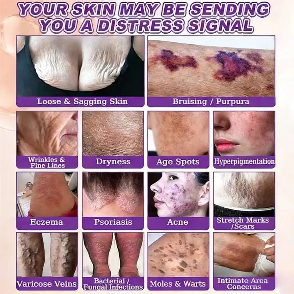 Skin distress condition chart Skin distress condition chart