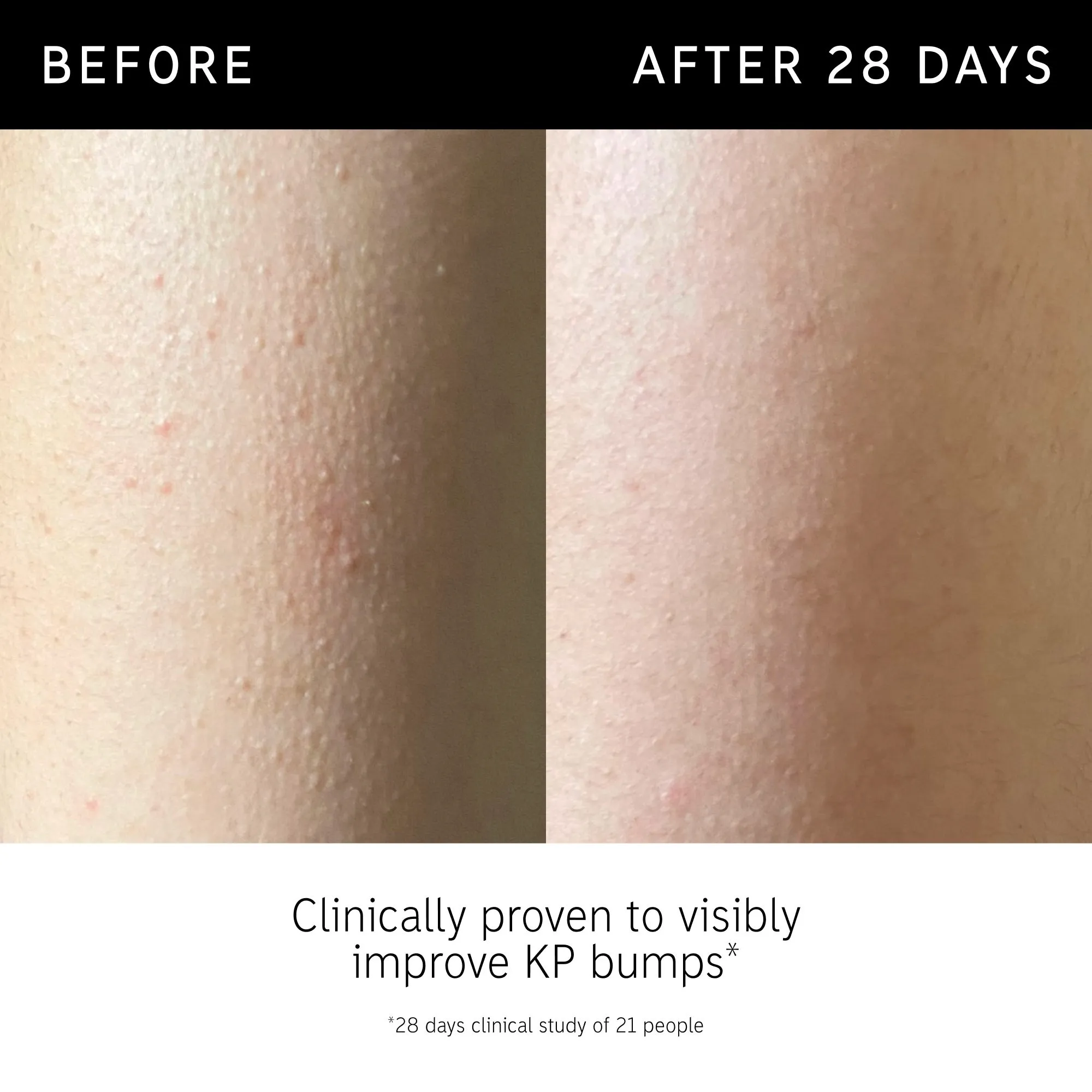 The INKEY List Glycolic Acid Exfoliating Body Stick 45g Image 3 The INKEY List Glycolic Acid Exfoliating Body Stick 45g Image 3