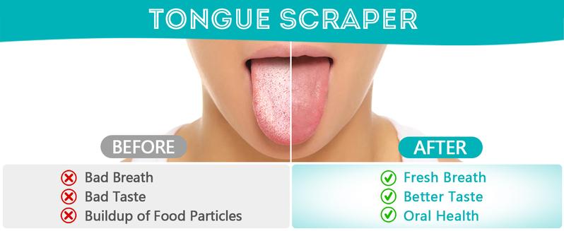 Product Introduction of 2 Pack Reduce Bad Breath U-Shape Stainless Steel for Adults Metal Cleaner for Oral Care and Fresher Breath Tongue Portable Scraper for Daily Care 5 Product Introduction of 2 Pack Reduce Bad Breath U-Shape Stainless Steel for Adults Metal Cleaner for Oral Care and Fresher Breath Tongue Portable Scraper for Daily Care 5