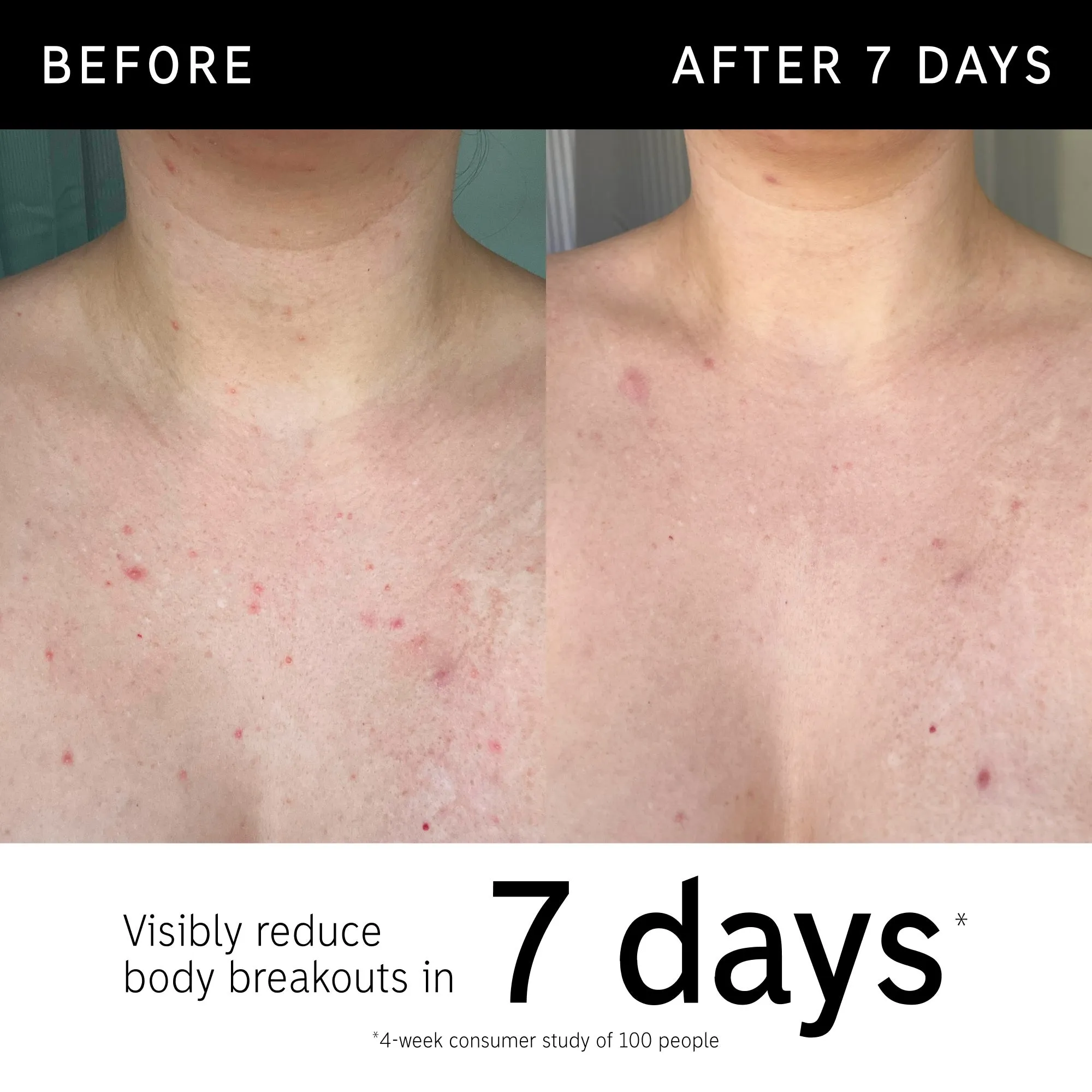 The INKEY List Glycolic Acid Exfoliating Body Stick 45g Image 2 The INKEY List Glycolic Acid Exfoliating Body Stick 45g Image 2