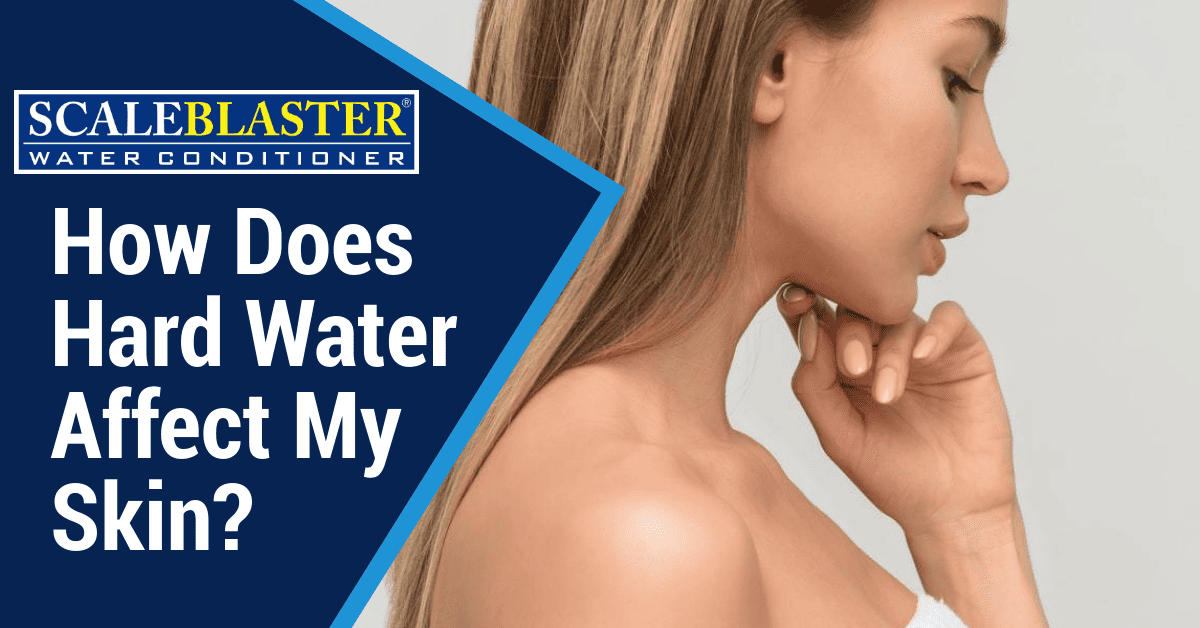 How Does Hard Water Affect My Skin? How Does Hard Water Affect My Skin?