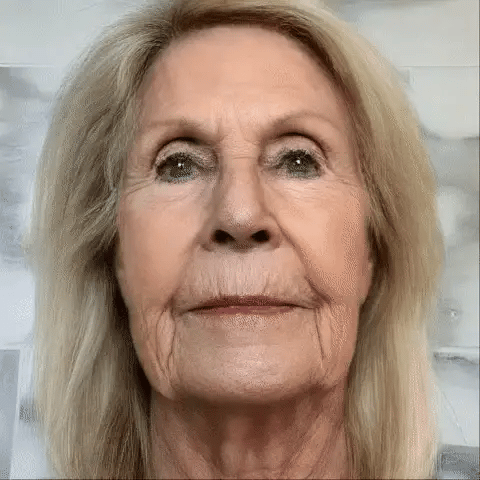 Susanne Lewis - Antes e depois